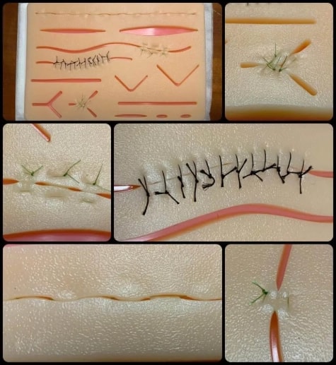 Suture Techniques